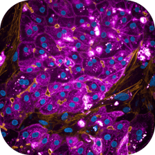 TruVivo_purple stain